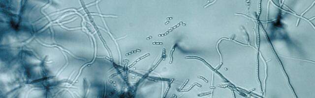 New Antibiotic Found in Dirt Targets Bacteria in a Way ‘Never Been Seen Before’