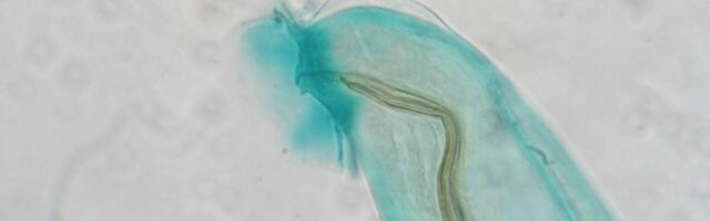 A Brain-Invading Worm Spread By Rats and Snails Has Reached California