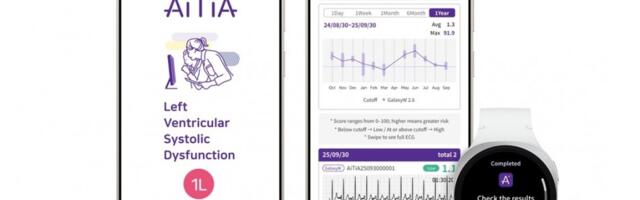 Samsung details upcoming cardiovascular condition detection via smartwatch