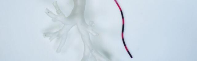 These tiny robotic tentacles could travel into the lungs to treat cancer