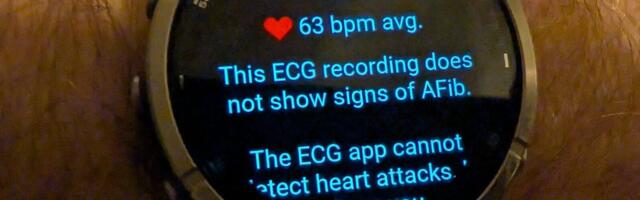 Garmin GPS Watches Are Bricking and Nobody Knows Why