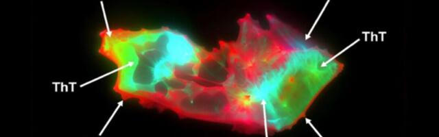 People With Long Covid Have This Freaky-Looking Thing in Their Blood