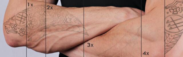 Ray Studios raises $3m to get rid of that tattoo of your ex’s name for good