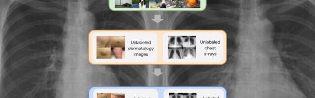 Google Research: Self-supervised learning is transforming medical imaging