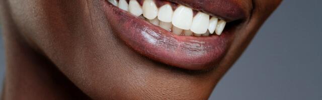Best Whitening Toothpaste of 2025, According to Dentists