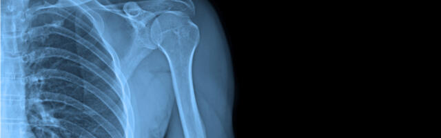 Healthcare projects split £9m NHS funding for cancer diagnosis tech