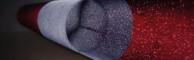 Dutch medtech firm Xeltis secures €12.5M from EIC Fund