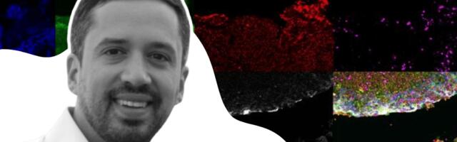 Schlieren-based life science startup arcoris bio lands €6.7 million to advance biomarker detection platform