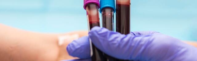 Stay on Top of These 6 Blood Tests to Make Sure You're Monitoring Your Health