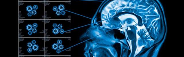 Микросервис головного мозга. Пилим всё, что движется