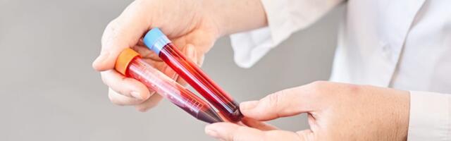 A $700 blood test promises to detect 50 different kinds of cancer. The results come with major caveats.