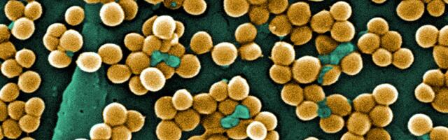 Атопический дерматит: мыши чешутся на 7 Гц яростнее наших укушенных сотрудников