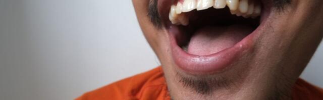 Your Brain Has Separate Circuits for Belly Laughs and Polite Chuckles