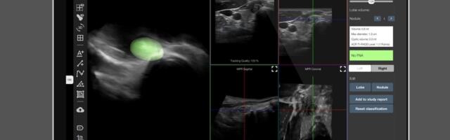 Austria's Piur Imaging raises €4.9 million to bring vendor-independent tomographic 3D ultrasound solution to the US