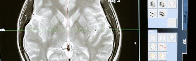 InsideOut Therapeutics: Mental Wellness Through Wearable Technology