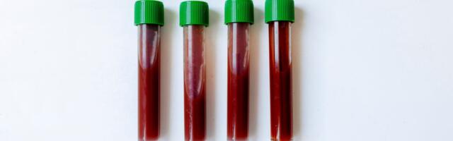 These Blood Types Are Most at Risk of Developing Heart Disease