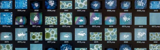 The challenge of creating brains in a lab