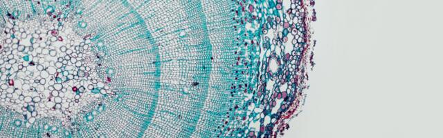 Decoding DNA with AI: Living Models emerges from stealth with $7M