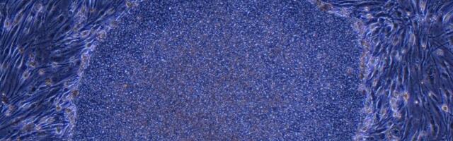 Japan Approves the World’s First Treatment Made With Reprogrammed Human Cells