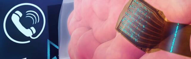 Race is on to beat Musk to develop thought-controlled devices