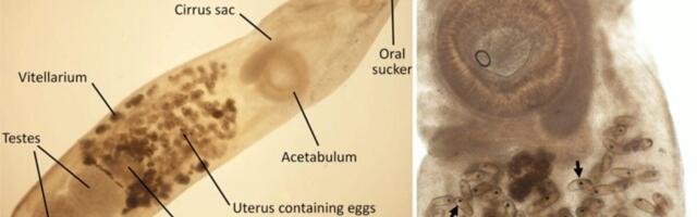 Woman Visits the Galápagos and All She Got Was This Exotic Eye Parasite