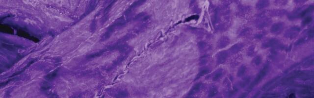 Impossibly Intricate Tattoos Found on 2,000-Year-Old ‘Ice Mummy’