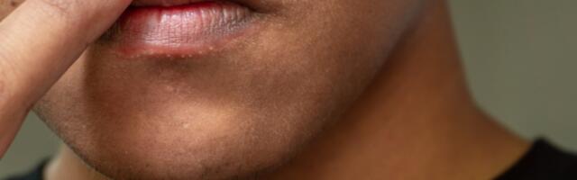Got Cold Sores? You Might Be at Higher Risk for Alzheimer’s