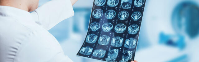 Hexarad closes £4.5m funding round for radiology optimisation