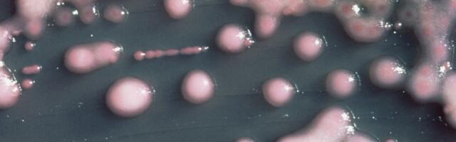 A woman got a UTI. Two years later, the bacteria had evolved, invaded her brain.