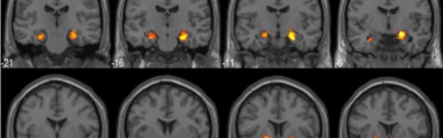 This Is What Your Brain Looks Like When You Solve a Problem