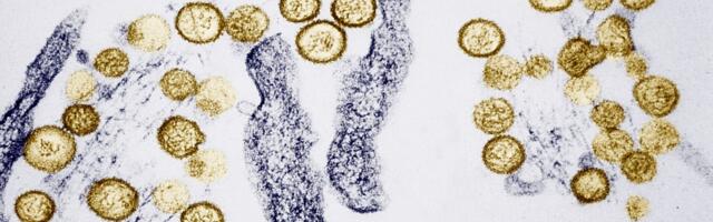 Australian Virus Lab Loses Track of Hundreds of Deadly Germs in ‘Major’ Biosecurity Breach