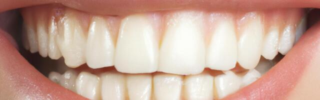 Is smart dental tech worth the cost?