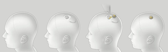 Elon Musk demonstrates Neuralink’s tech live using pigs with surgically-implanted brain monitoring devices
