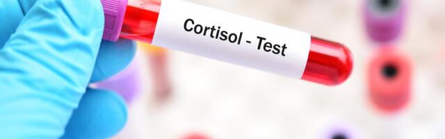 Should We Be Stressed About Our Cortisol Levels? I Got a Blood Stress Test to Find Out