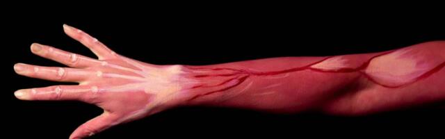 Munich-based Noxon closes Seed funding to turn muscles into digital interfaces for neuromuscular care