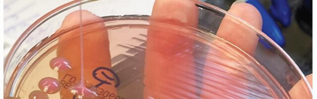 This may be the grossest eye pic ever—but the cause is what’s truly horrifying