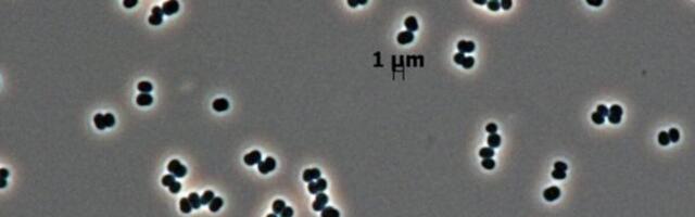 This Microbe ‘Plays Dead’ in NASA Clean Rooms, and We May Have Sent It to Mars