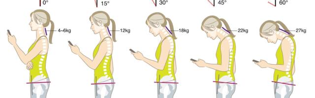 Как проблемы с прикусом и зубами могут усугубить компьютерную шею