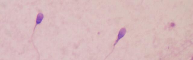 Utah Startup Claims Its Lab-Grown Sperm Can Produce Embryos, in Potential Fertility Breakthrough