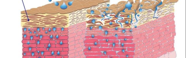 Если зимой мазать руки увлажняющим кремом — будет только хуже — fixed