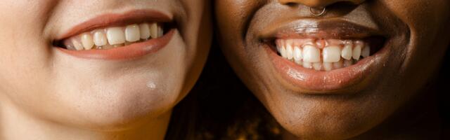 The lipstick mistake that makes teeth look yellow and lips look older