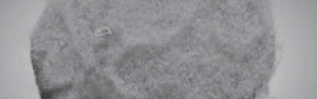 Tiny chips hitch a ride on immune cells to sites of inflammation