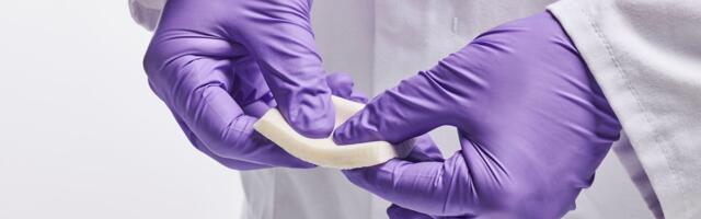 Welsh biotech extracting collagen from jellyfish raises £8.7m