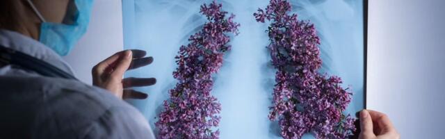 Biotech Refoxy Pharmaceuticals advances research with €9.1M funding