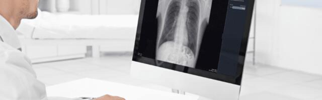 Promedius Redefines Osteoporosis Diagnosis with AI: Pioneering Korean Startup Advances Healthcare Innovation Globally