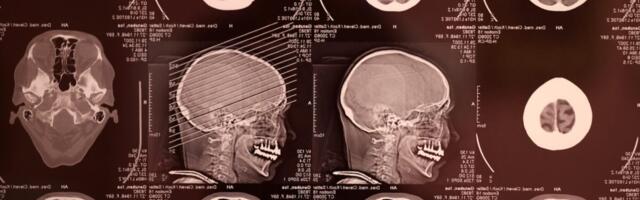 Meta’s AI Is Getting Better at Reading Your Thoughts—Without Cracking Open Your Skull
