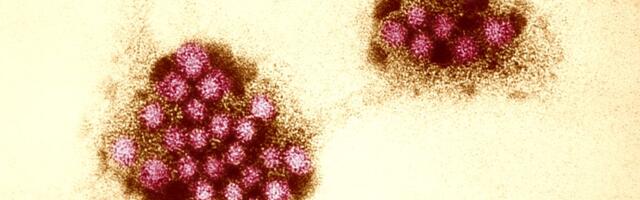 Saliva that fights norovirus? Experimental oral vaccine is nothing to spit at.