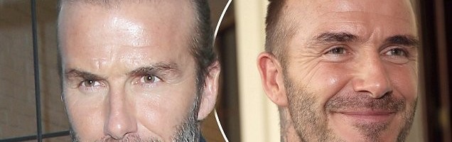 Wondering What Hair Restoration Technique is Right for you?