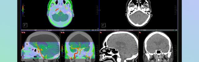 Apple's Studio Display XDR Supports DICOM Medical Imaging for Diagnostic Radiology