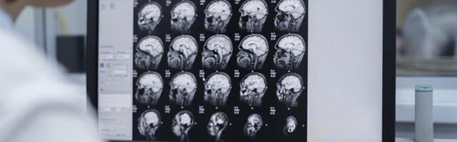 Brainreader raises €6.6M to expand AI-driven neurological diagnostic platform